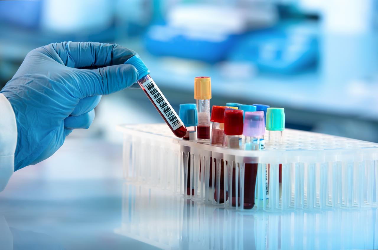 Hand with personal protective equipment taking a laboratory blood sample to be examined